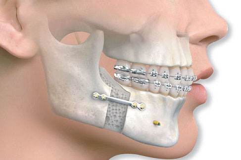 <span style="color: rgb(31, 31, 31);">Челюстно-лицевые хирурги</span>