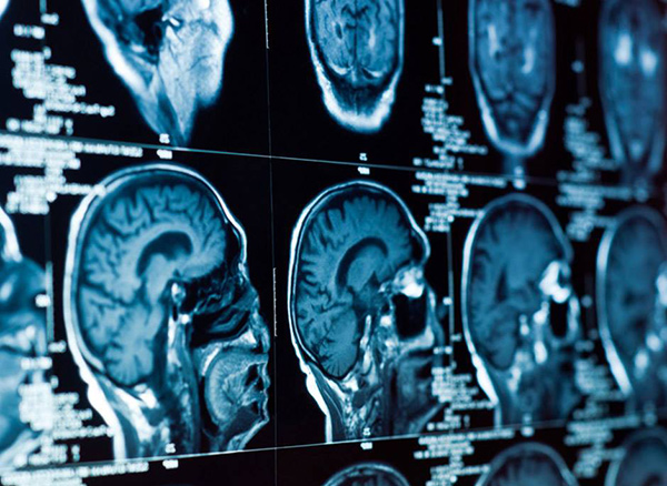 <strong>СНО кафедр</strong>